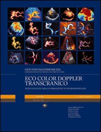 Eco color doppler transcranico